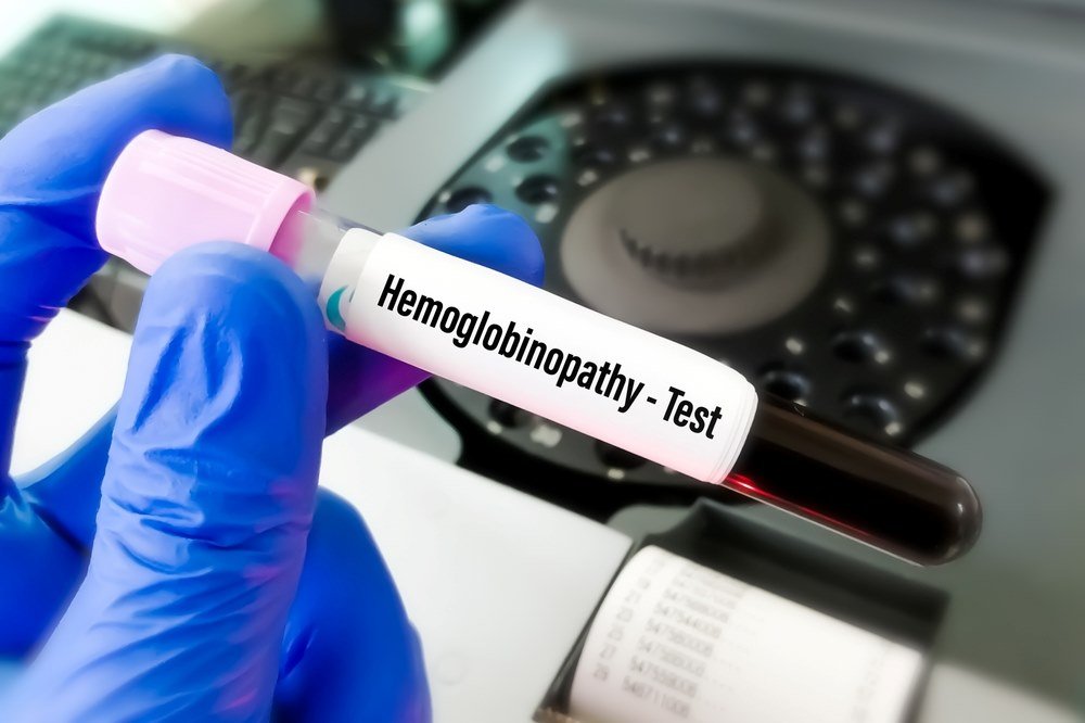 Hematologist Surgeon in Ahmedabad