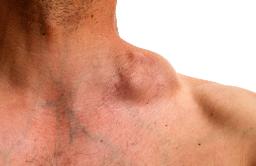 Best Haemato Oncologist Surgeon in Ahmedabad