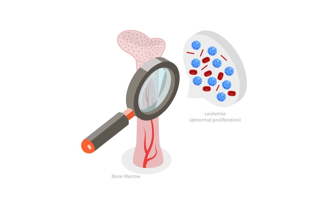 Trusted Hematologist in Ahmedabad